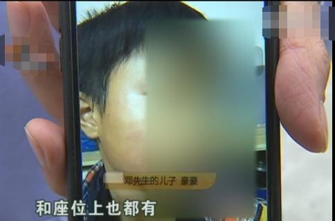 孩子校車上被打耳光，父親找到學(xué)校要說法，校長：老師心情不好