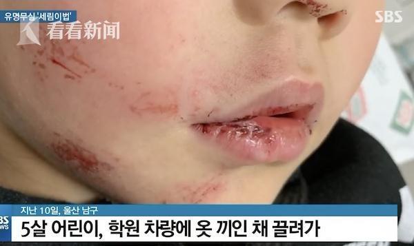 5歲女孩下校車時被門夾住 司機沒注意繼續(xù)拖行